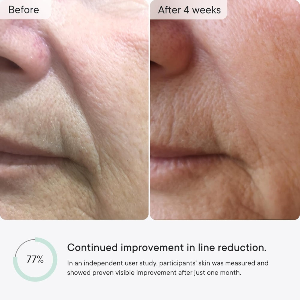 SkinInfuse™ – Micro-Infusion Anti-Wrinkle Patches