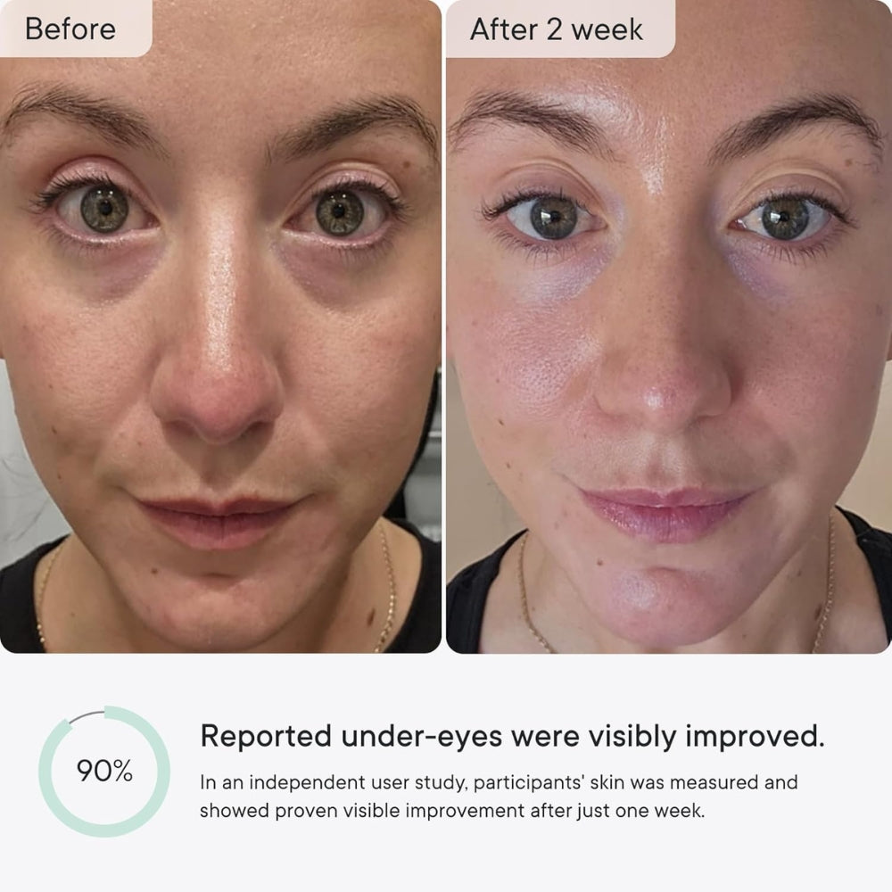 SkinInfuse™ – Micro-Infusion Anti-Wrinkle Patches